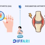 difference between oa and ra